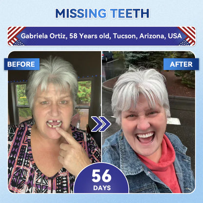 Your Smile~ 🦷 Tideglusib Fast‑Dissolving Tooth & Gum Repair Oral Strips ✨ (𝟓-𝐢𝐧-𝟏 💎 𝐑𝐞𝐛𝐮𝐢𝐥𝐝 𝐄𝐧𝐚𝐦𝐞𝐥 & 𝐃𝐞𝐧𝐭𝐢𝐧 • 𝐒𝐭𝐫𝐞𝐧𝐠𝐭𝐡𝐞𝐧 𝐆𝐮𝐦𝐬 • 𝐄𝐫𝐚𝐝𝐢𝐜𝐚𝐭𝐞 𝐓𝐚𝐫𝐭𝐚𝐫 & 𝐎𝐝𝐨𝐫 • 𝐖𝐡𝐢𝐭𝐞𝐧𝐢𝐧𝐠 • 𝐒𝐭𝐨𝐩 𝐓𝐨𝐨𝐭𝐡 𝐒𝐞𝐧𝐬𝐢𝐭𝐢𝐯𝐢𝐭𝐲)
