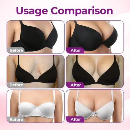 Ends Tonight: 50% OFF - NATRAVOR® Targeted Breast Enhancement Advanced Nano Microneedle Patch
