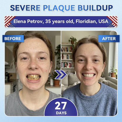 Your Smile~ 🦷 Tideglusib Fast‑Dissolving Tooth & Gum Repair Oral Strips ✨ (𝟓-𝐢𝐧-𝟏 💎 𝐑𝐞𝐛𝐮𝐢𝐥𝐝 𝐄𝐧𝐚𝐦𝐞𝐥 & 𝐃𝐞𝐧𝐭𝐢𝐧 • 𝐒𝐭𝐫𝐞𝐧𝐠𝐭𝐡𝐞𝐧 𝐆𝐮𝐦𝐬 • 𝐄𝐫𝐚𝐝𝐢𝐜𝐚𝐭𝐞 𝐓𝐚𝐫𝐭𝐚𝐫 & 𝐎𝐝𝐨𝐫 • 𝐖𝐡𝐢𝐭𝐞𝐧𝐢𝐧𝐠 • 𝐒𝐭𝐨𝐩 𝐓𝐨𝐨𝐭𝐡 𝐒𝐞𝐧𝐬𝐢𝐭𝐢𝐯𝐢𝐭𝐲)