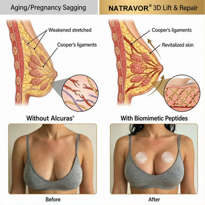Ends Tonight: 50% OFF - NATRAVOR® Targeted Breast Enhancement Advanced Nano Microneedle Patch