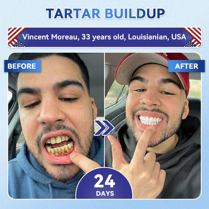 Your Smile~ 🦷 Tideglusib Fast‑Dissolving Tooth & Gum Repair Oral Strips ✨ (𝟓-𝐢𝐧-𝟏 💎 𝐑𝐞𝐛𝐮𝐢𝐥𝐝 𝐄𝐧𝐚𝐦𝐞𝐥 & 𝐃𝐞𝐧𝐭𝐢𝐧 • 𝐒𝐭𝐫𝐞𝐧𝐠𝐭𝐡𝐞𝐧 𝐆𝐮𝐦𝐬 • 𝐄𝐫𝐚𝐝𝐢𝐜𝐚𝐭𝐞 𝐓𝐚𝐫𝐭𝐚𝐫 & 𝐎𝐝𝐨𝐫 • 𝐖𝐡𝐢𝐭𝐞𝐧𝐢𝐧𝐠 • 𝐒𝐭𝐨𝐩 𝐓𝐨𝐨𝐭𝐡 𝐒𝐞𝐧𝐬𝐢𝐭𝐢𝐯𝐢𝐭𝐲)