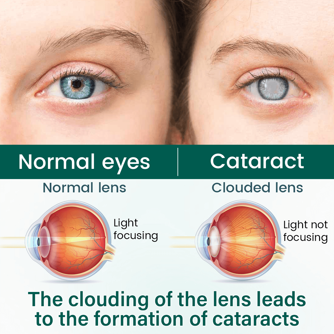 NATRAVOR OptiClear Nano Eye Roller Serum