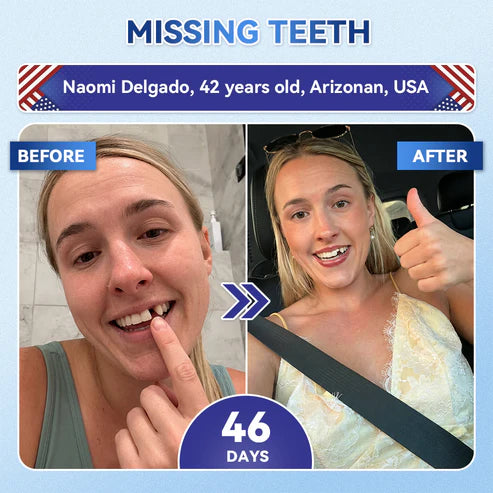 Your Smile~ 🦷 Tideglusib Fast‑Dissolving Tooth & Gum Repair Oral Strips ✨ (𝟓-𝐢𝐧-𝟏 💎 𝐑𝐞𝐛𝐮𝐢𝐥𝐝 𝐄𝐧𝐚𝐦𝐞𝐥 & 𝐃𝐞𝐧𝐭𝐢𝐧 • 𝐒𝐭𝐫𝐞𝐧𝐠𝐭𝐡𝐞𝐧 𝐆𝐮𝐦𝐬 • 𝐄𝐫𝐚𝐝𝐢𝐜𝐚𝐭𝐞 𝐓𝐚𝐫𝐭𝐚𝐫 & 𝐎𝐝𝐨𝐫 • 𝐖𝐡𝐢𝐭𝐞𝐧𝐢𝐧𝐠 • 𝐒𝐭𝐨𝐩 𝐓𝐨𝐨𝐭𝐡 𝐒𝐞𝐧𝐬𝐢𝐭𝐢𝐯𝐢𝐭𝐲)