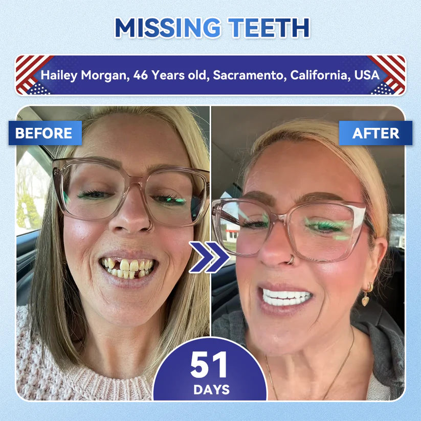 Your Smile~ 🦷 Tideglusib Fast‑Dissolving Tooth & Gum Repair Oral Strips ✨ (𝟓-𝐢𝐧-𝟏 💎 𝐑𝐞𝐛𝐮𝐢𝐥𝐝 𝐄𝐧𝐚𝐦𝐞𝐥 & 𝐃𝐞𝐧𝐭𝐢𝐧 • 𝐒𝐭𝐫𝐞𝐧𝐠𝐭𝐡𝐞𝐧 𝐆𝐮𝐦𝐬 • 𝐄𝐫𝐚𝐝𝐢𝐜𝐚𝐭𝐞 𝐓𝐚𝐫𝐭𝐚𝐫 & 𝐎𝐝𝐨𝐫 • 𝐖𝐡𝐢𝐭𝐞𝐧𝐢𝐧𝐠 • 𝐒𝐭𝐨𝐩 𝐓𝐨𝐨𝐭𝐡 𝐒𝐞𝐧𝐬𝐢𝐭𝐢𝐯𝐢𝐭𝐲)