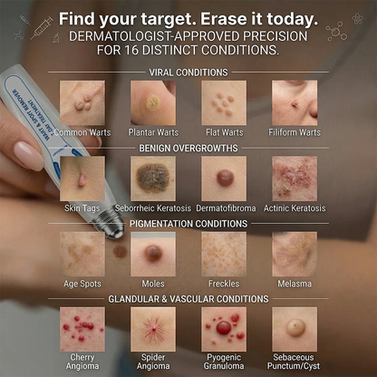 NATRAVOR® 𝟕-𝐃𝒂𝘆 𝐒𝗸𝐢𝐧 𝐓𝒂𝗴 & 𝐒𝐩𝙤𝐭 𝐄𝐫𝒂𝐬𝙚𝐫 Painless & Scar-Free Advanced Imperfection Remova𝗜 Ro𝗜𝗜erba𝗜𝗜 Pen 🌿