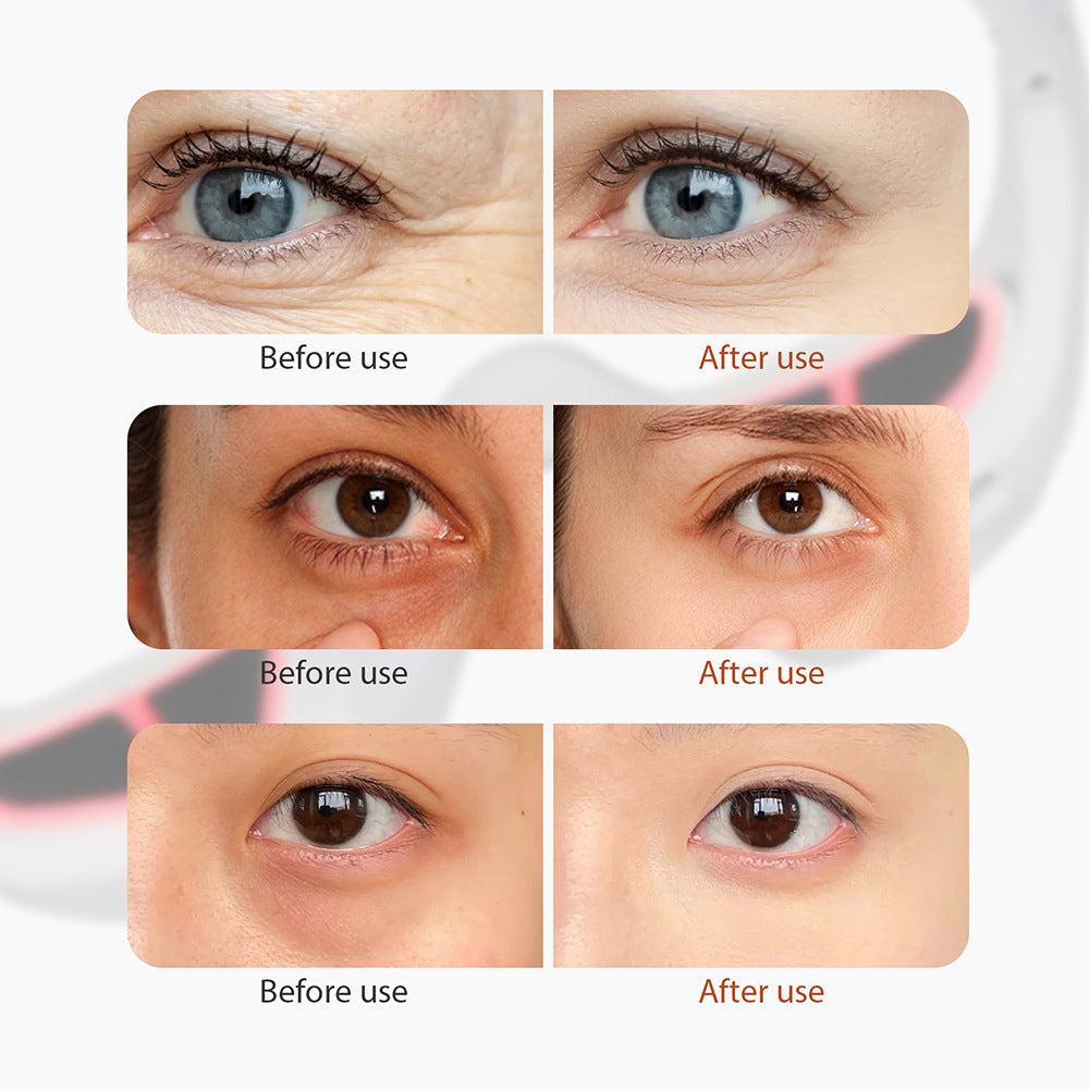 Microcurrent eye massager, eye beauty device, eye cream import device