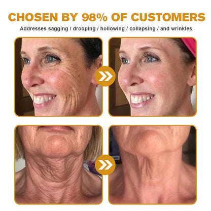 ✨Botox Bee Venom Wrinkle Removal Cream