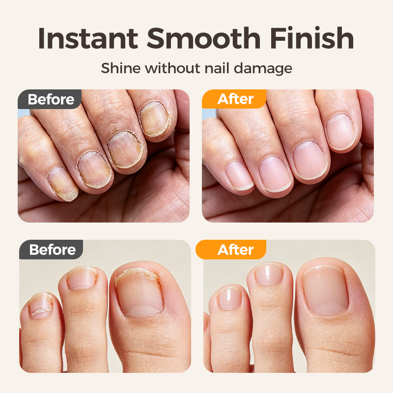 🔥 Medical-Grade Nail Care Device
